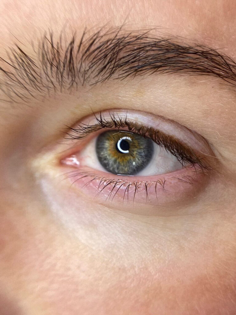 Permanent eyelid makeup_01_